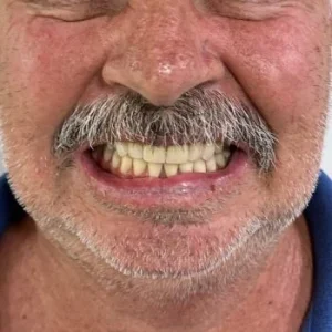 01-DEPOIS-qlsiunz7g1jiv8uwcjzt6ab0i8zpztxe13foks5k4s