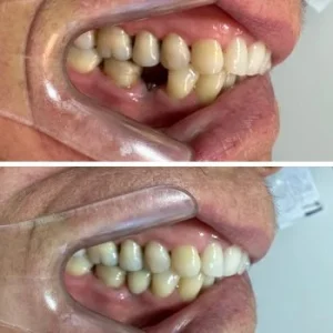 03-ANTES-E-DEPOIS-qlsiuk7uopedkt0cyidawb964pi951igoktqnob4to