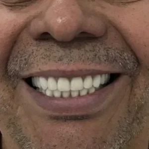 06-DEPOIS-qlsiufinqj7xyr76pyc61ufv5s5f2jzszxkb9ai3os