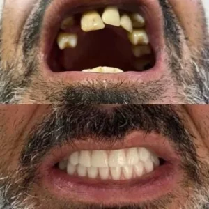 07-ANTES-E-DEPOIS-qlsiudmzcv5dbj9x0xiwwuwxz0eon5scbo9caqkw18